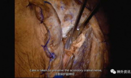 解剖视频,视频解析与知识概览